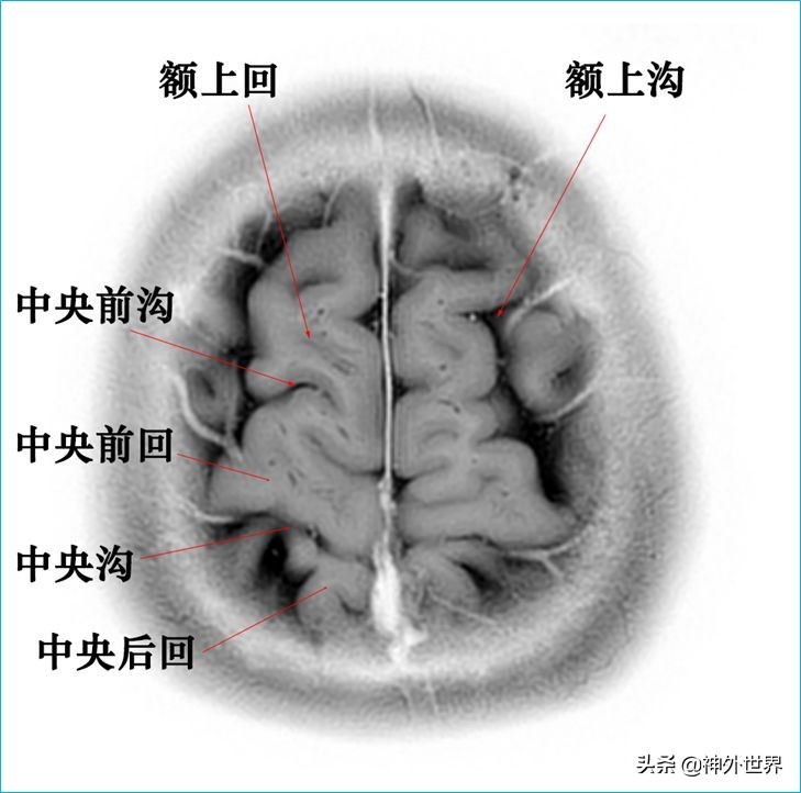 脑解剖学讲解视频全集,脑功能解剖学习