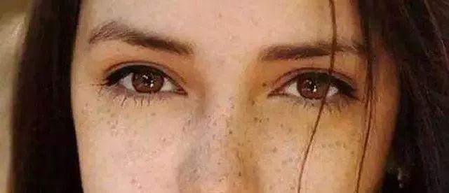 宝露斯精华液,宝露斯肌肤