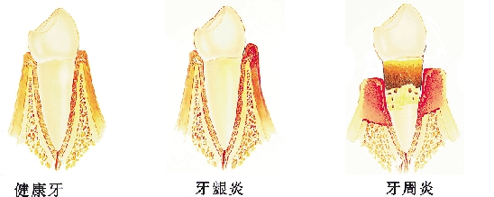 给老子的老师瞧瞧牙病