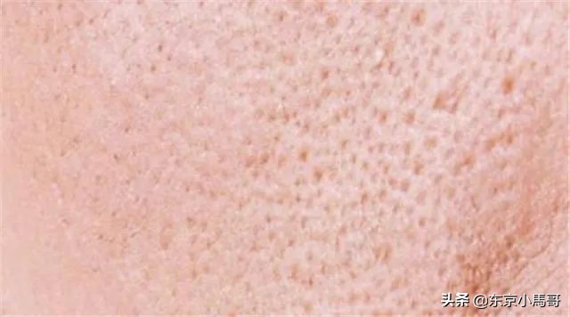 改善毛孔粗大的护肤习惯,可以改善毛孔粗大的护肤方法