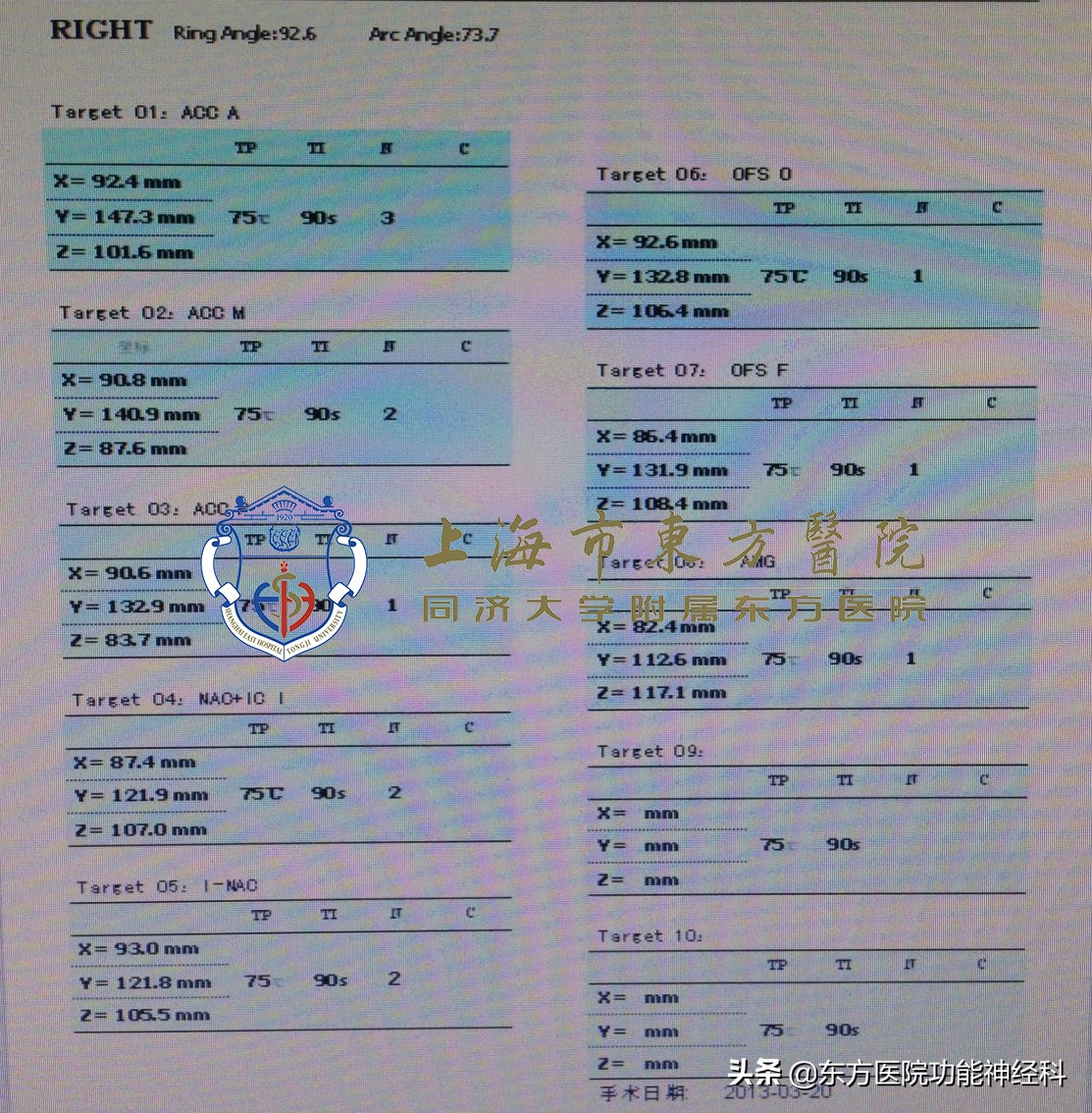 难治性精神病有必要外科手术吗,手术治疗精神病的成功率