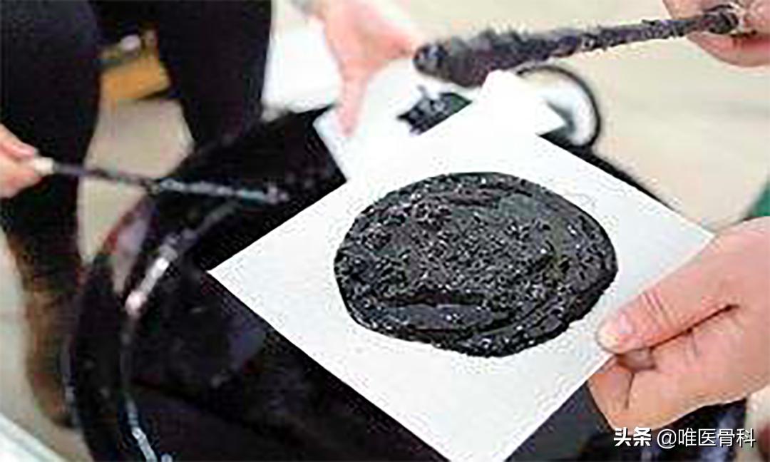 腰酸背痛就用万通筋骨贴,累的腰酸背痛贴膏药管用吗