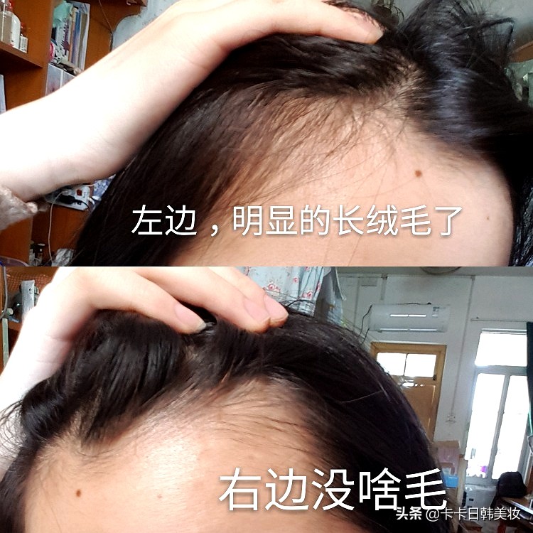 经常掉头发有什么好的洗发水,柳屋生发液真实测评还能用吗