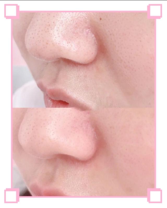 法国大宝隔离霜有防晒吗,大宝隔离霜哪个好用