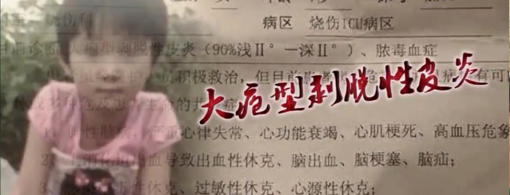 8岁女孩罕见怪病后续,8岁女孩罕见怪病