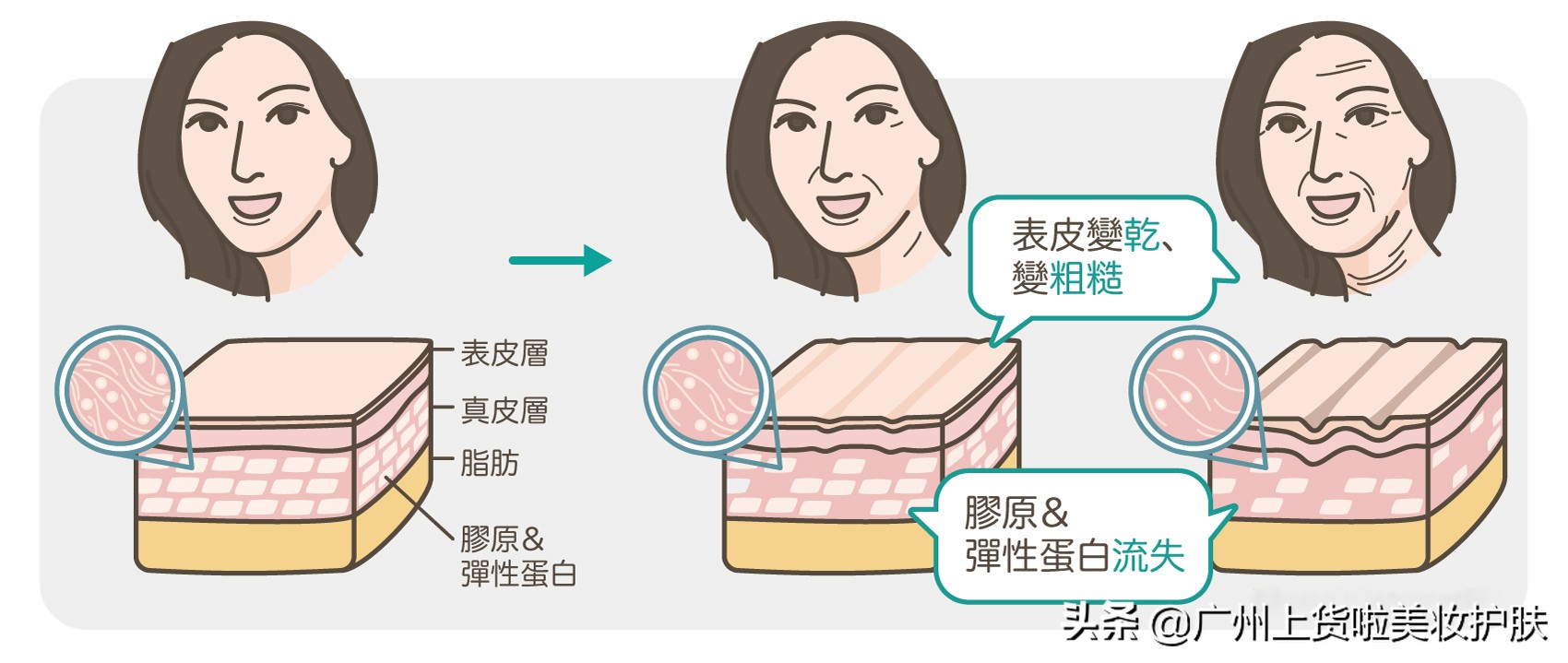 一招解决抬头纹的方法,跟抬头纹说拜拜