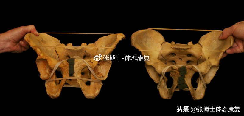 膝内扣和小腿外翻先纠正哪个,膝内扣膝盖外翻