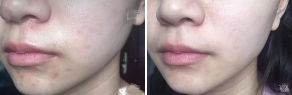 张天爱视频用的保养护肤面霜,张天爱作息曝光视频