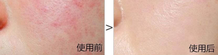 堪比大牌的平价乳霜,日本平价保湿面霜推荐