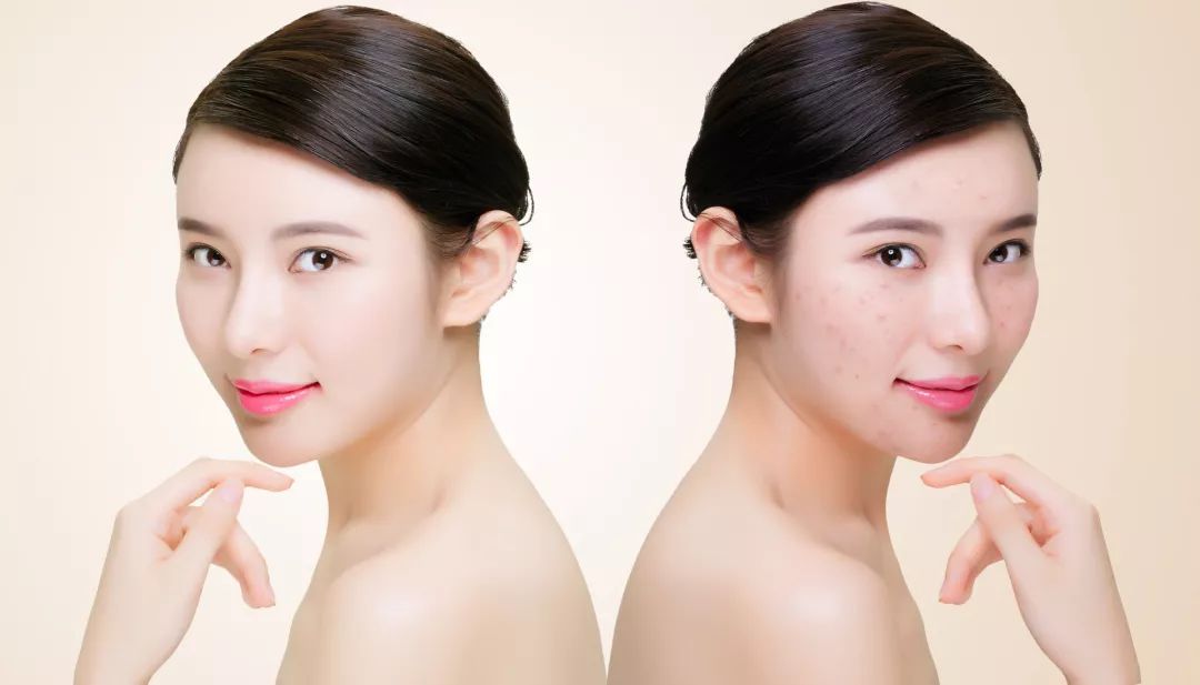 换季皮肤干燥过敏怎么食疗,皮肤干燥过敏怎么补水最快