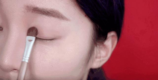 怎样避免眼周长脂肪粒,10%尿素霜可以治疗眼周脂肪粒吗