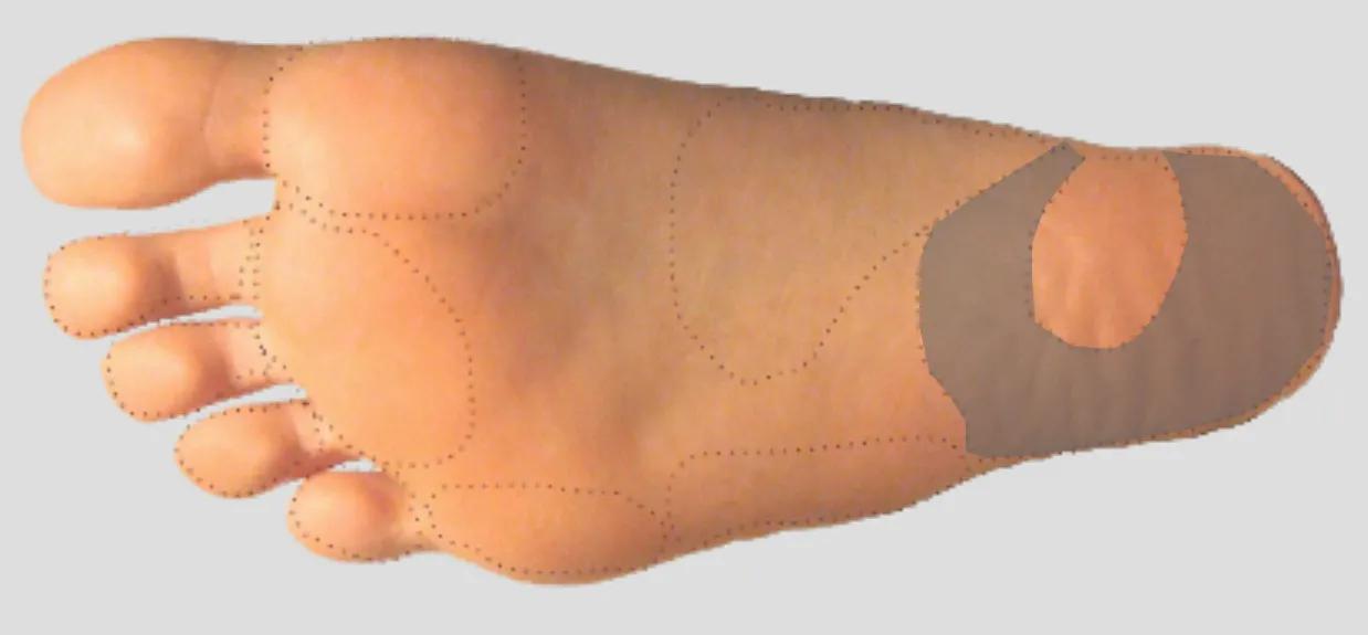 足踝外侧足底疼痛,内踝下方靠近足底的哪个位置痛