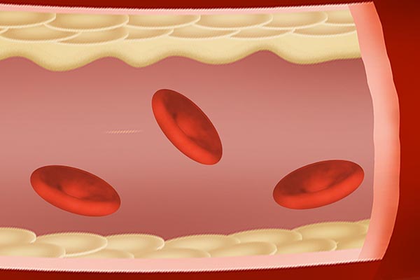 你身上长出好多小红痣是什么原因,身上手上长小红痣不痛不痒