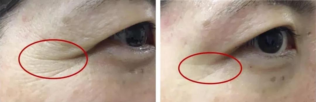 38岁全智贤不愧是国民女神 (年轻时的全智贤满满的胶原蛋白)