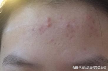 新手卸妆和护肤正确步骤,如何卸妆正确的卸妆步骤是怎样的