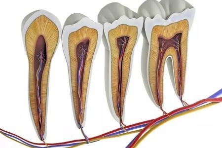 口腔科医生：什么是牙髓炎？牙髓炎主要有哪些症状？