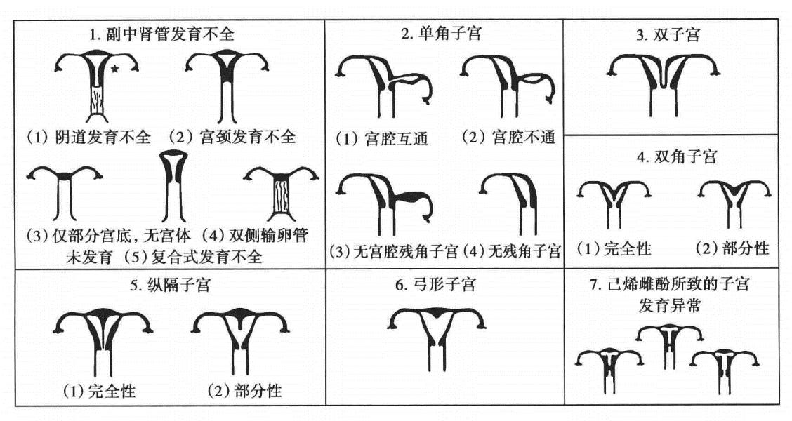 突然开始痛经可能是什么造成,痛经是子宫不健康吗