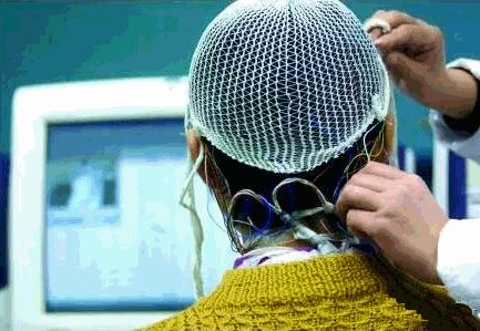 癫痫患者必须要遵循哪些服药原则？