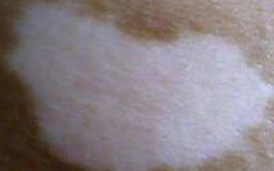 白癜风治疗过程,患白癜风怎么办的视频