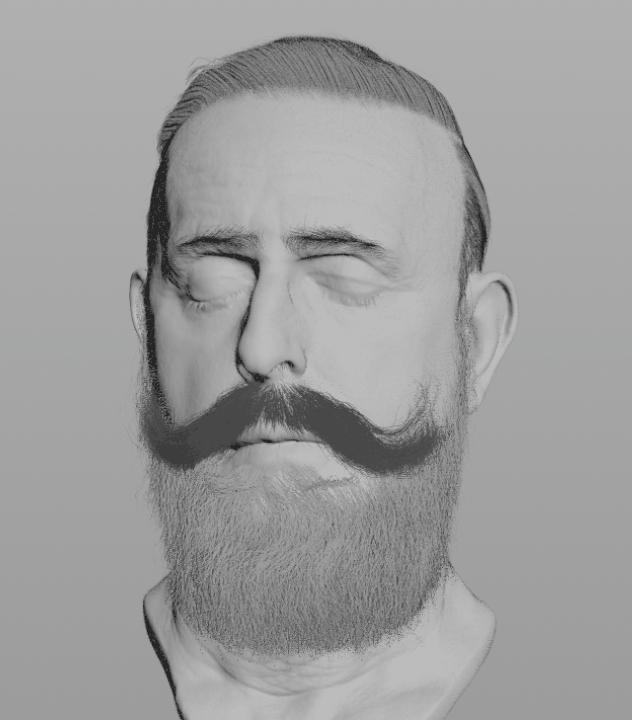 3d防脱发动画,毛发生长3d动画