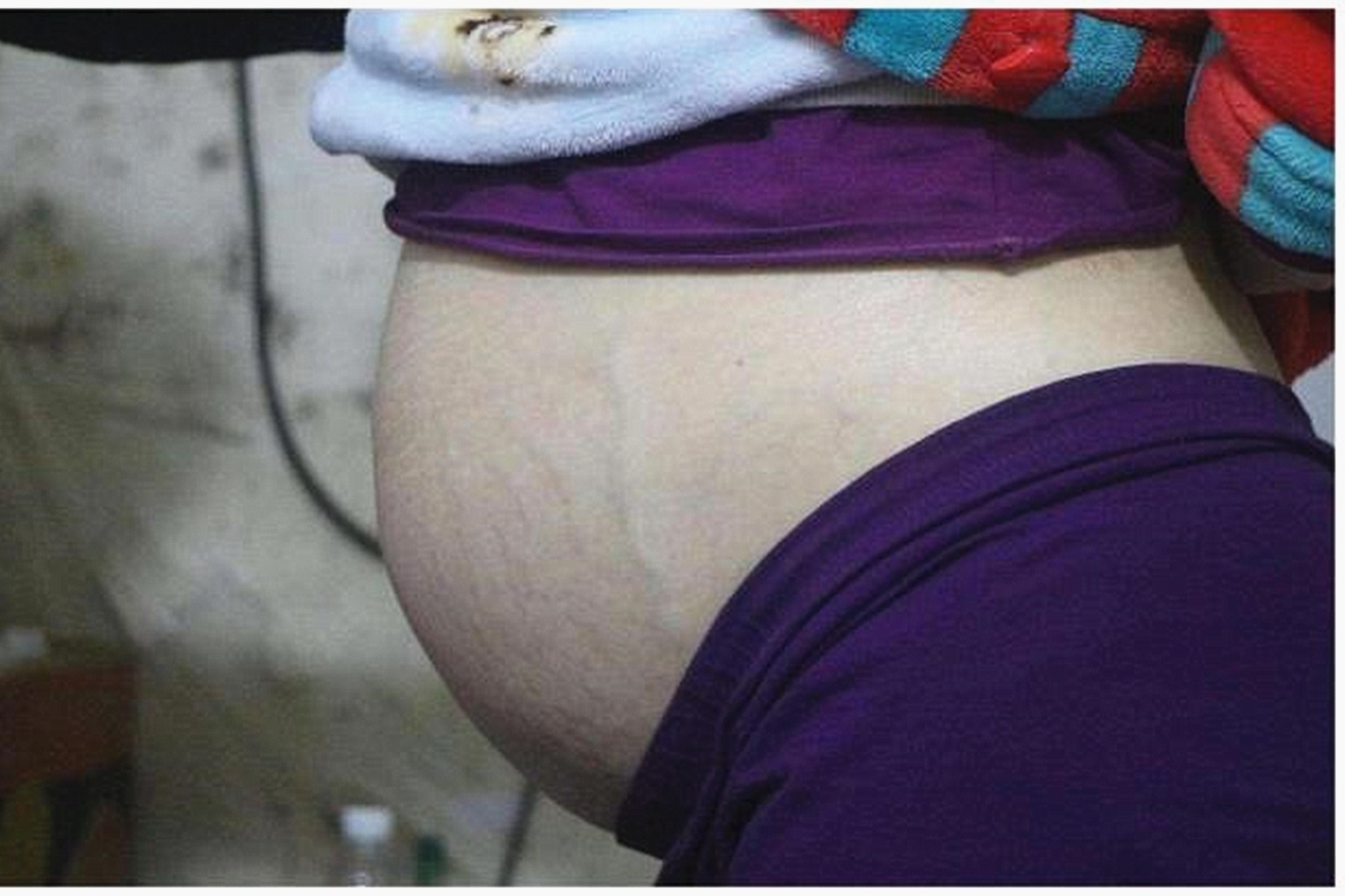 40岁产妇孕43周,43岁高龄孕期40周