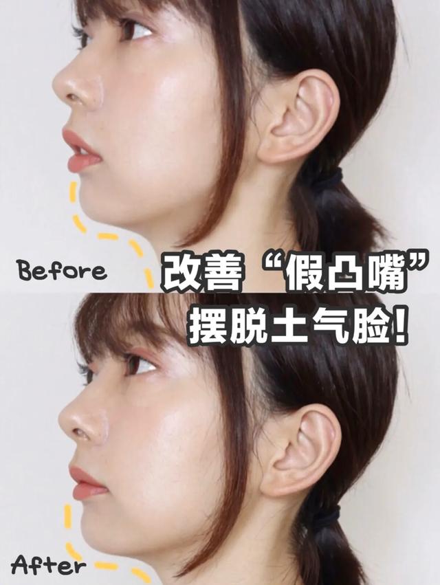 侧颜凸嘴怎么修,让侧脸变好看的方法