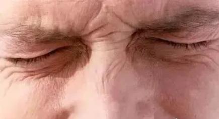 皱纹变多的症状,最近为什么突然有皱纹了