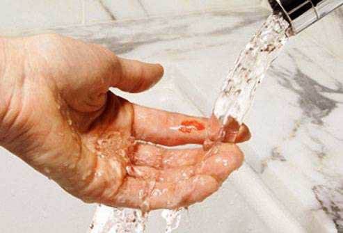 狂犬病疫苗死亡率,狂犬病疫苗注射的注意事项有哪些