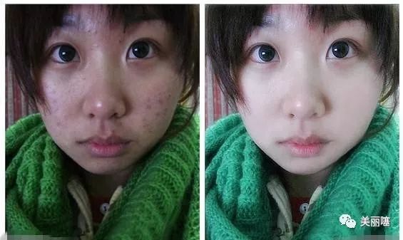 为什么微商的品牌化妆品那么便宜,微商的大牌化妆品为什么那么便宜