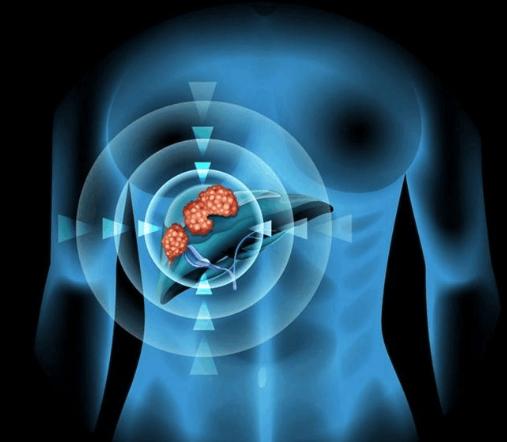 印度肝癌靶向药价格表,全球最新肝癌靶向药价格表一览表