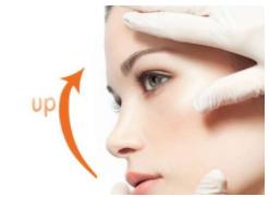 科普线雕会有哪些后遗症,线雕解密