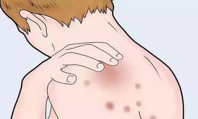 皮肤痒使用的软膏推荐,治疗皮肤痒的药膏对照大全