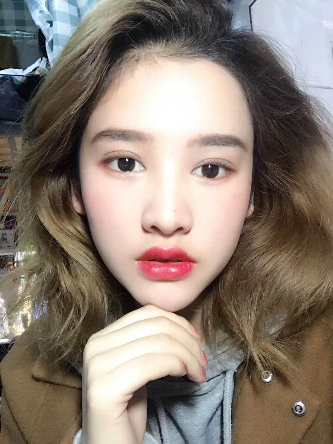 做了埋线双眼皮后悔了,做完双眼皮后悔的多吗