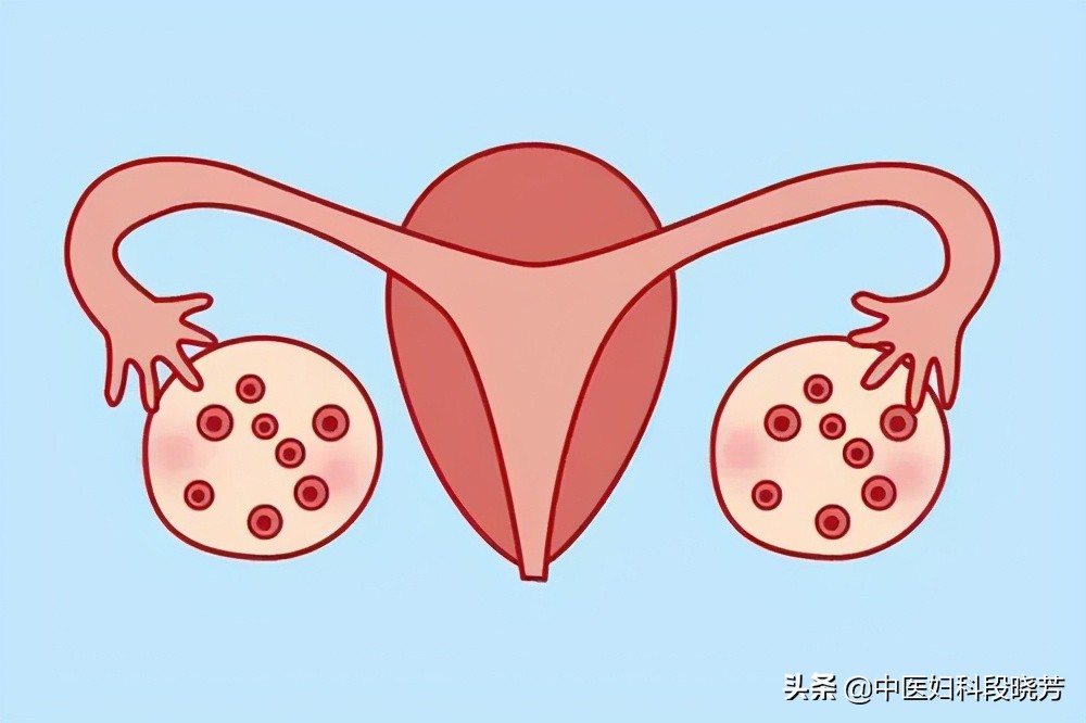 中医段晓芳治多囊贵吗,段晓芳治疗多囊卵巢