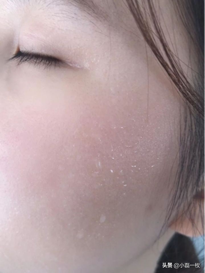 怎么内养皮肤,皮肤粗糙暗黄毛孔粗大怎么内调