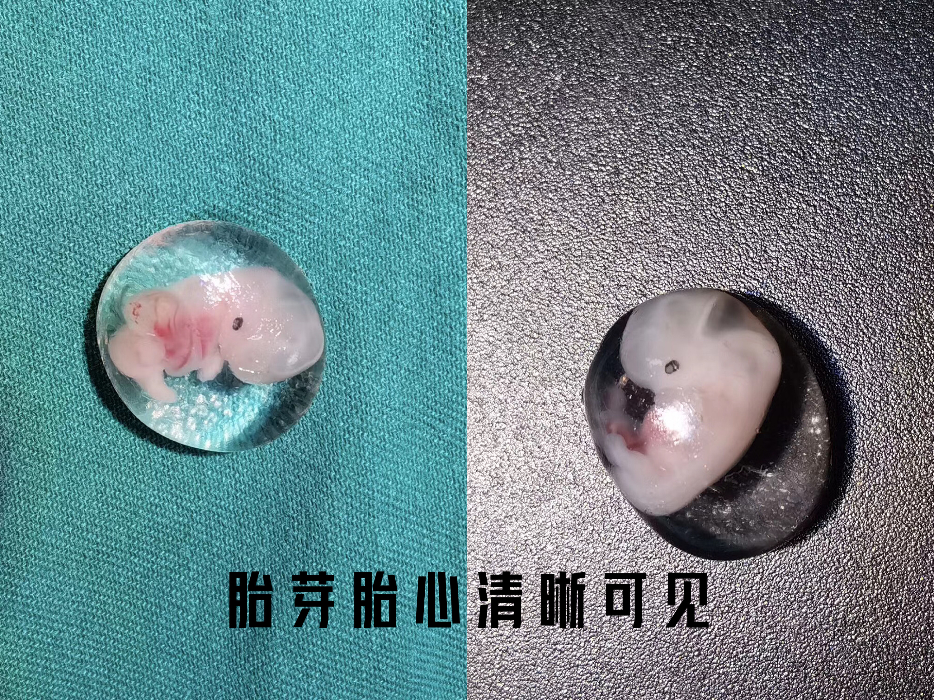 月经淋漓不尽突然大出血啥原因,月经淋漓不尽还腹痛腹胀是什么病