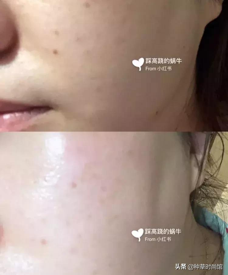 脸色暗黄干皮怎么变白最快方法,暗黄皮用什么护肤品变白