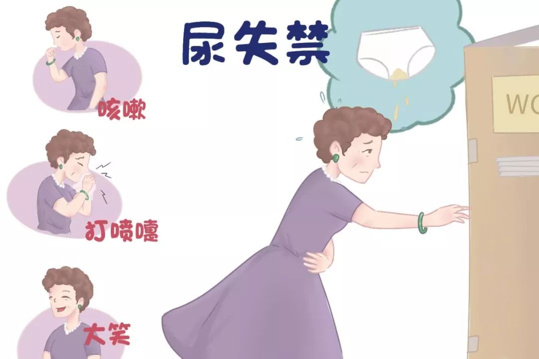 很多女性的尴尬事：一打喷嚏就漏尿！这些尿*禁失**病因须注意（下）