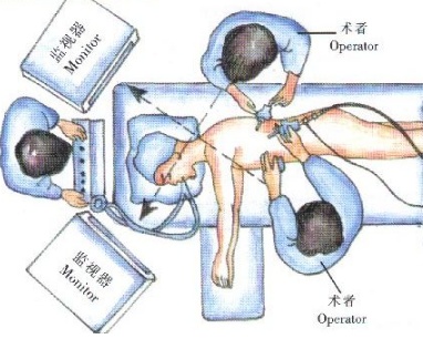 胸腔镜微创手术前后注意事项,胸腔镜术后多久可以再做胸腔镜