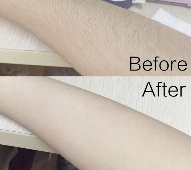 脱毛好物推荐,超平价脱毛推荐