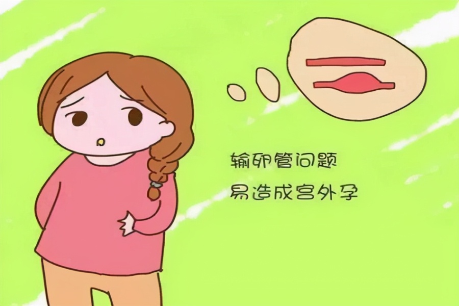 明明来了“月经”，为何医生说是“宫外孕”？