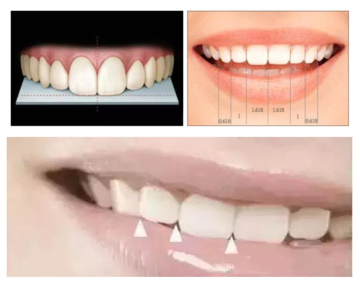 美丽人生从牙齿出发,美丽人生从口腔护理开始