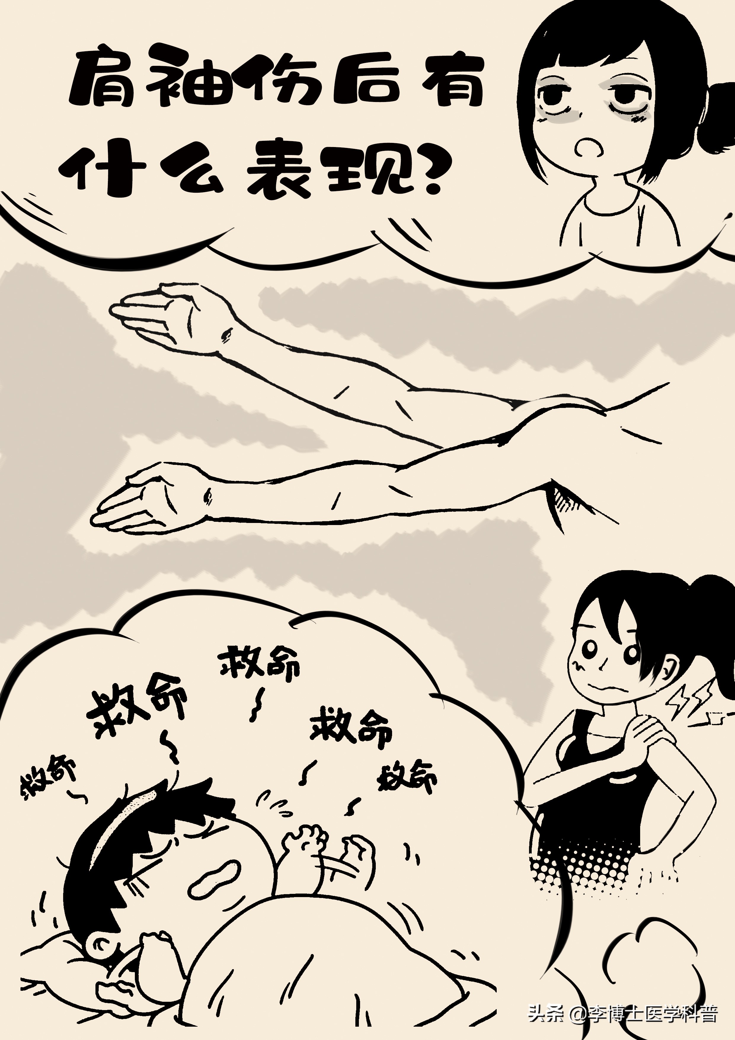 肩袖损伤科普视频参赛作品,肩袖损伤的诊疗体会