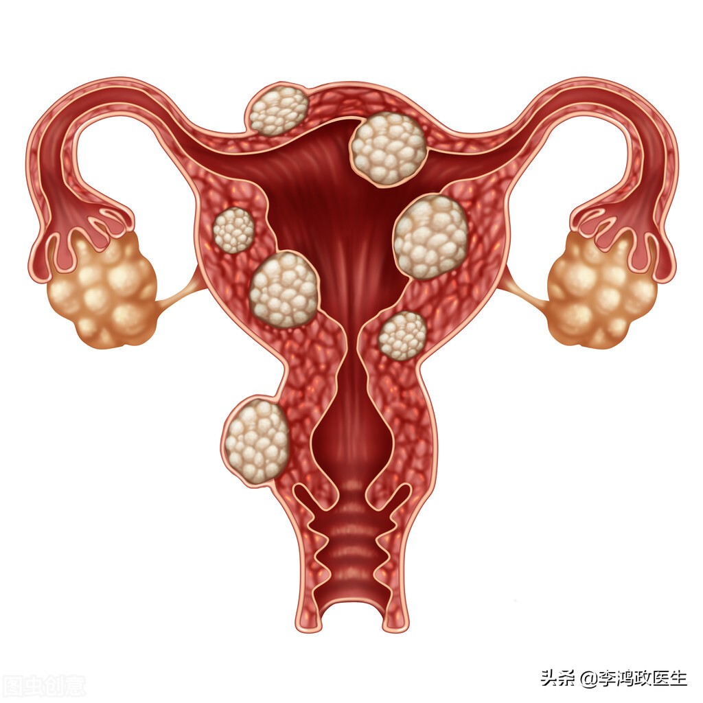 女子头晕，吃了无数补品无效，医生看到牙龈：可能需要把子宫切除