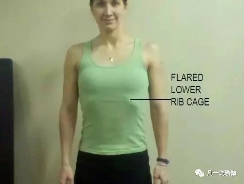 肋骨外翻的正确矫正方法,怎样改善肋骨外翻