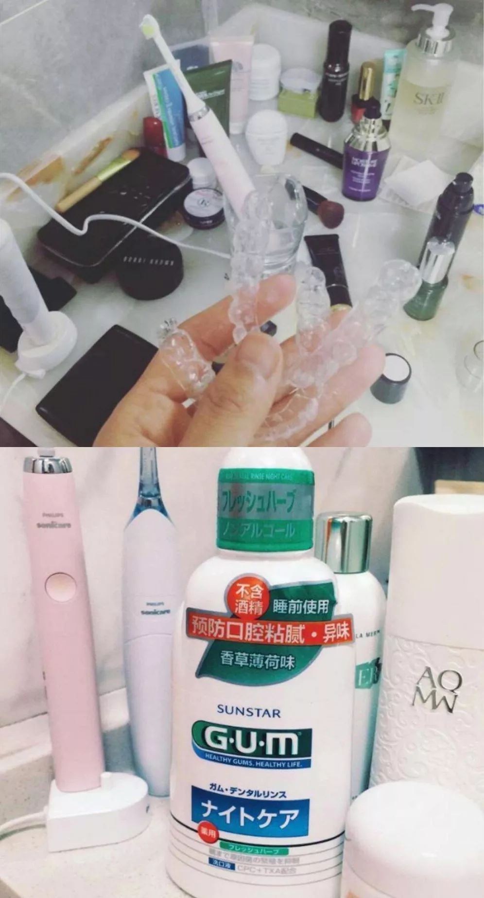 龅牙矫正前后对比照片,龅牙修复效果图