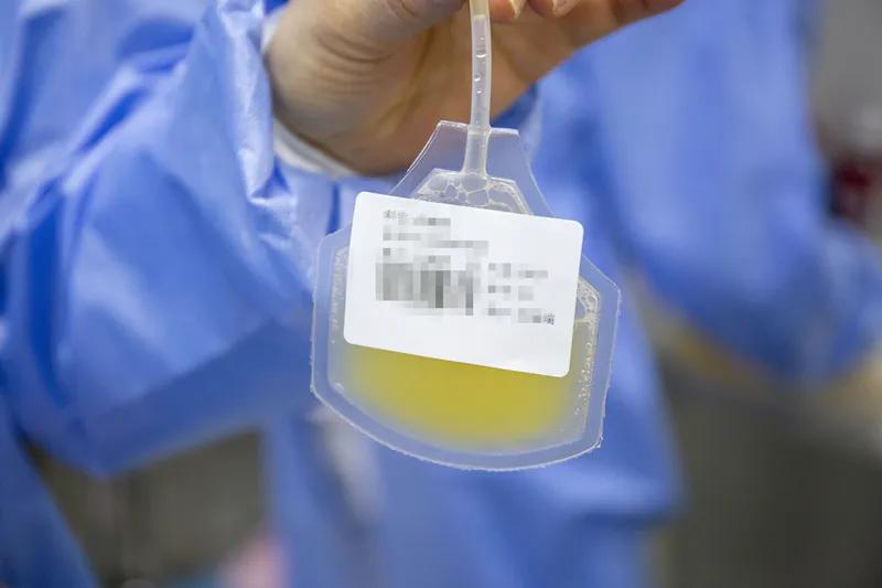 prp自体治疗,自体prp注射