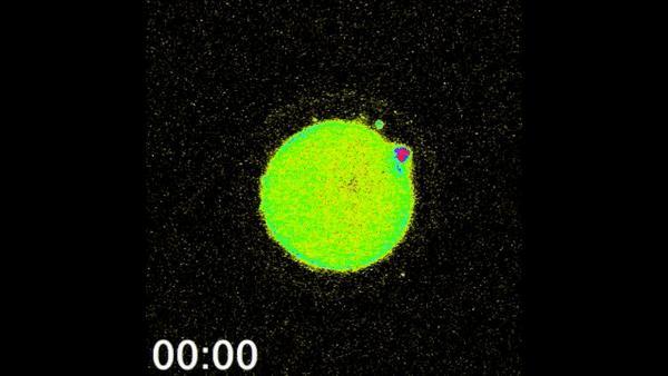 显微镜下的人类卵子和精子,人类首次拍到卵细胞