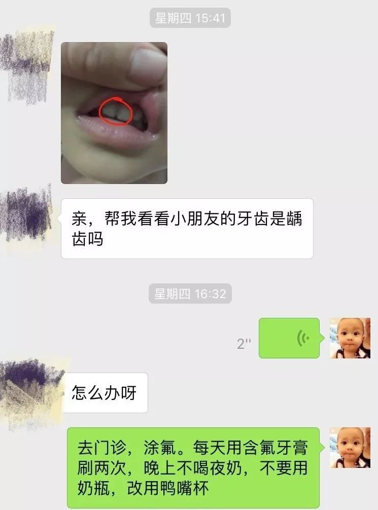 牙齿黑的地方是不是虫牙,黄牙黑牙有什么方法解决