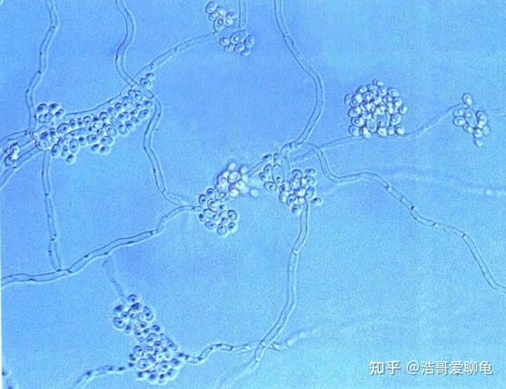 宠物龟泡腐皮净一般多久,幼龟长白点腐皮